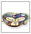 Seahorse Dish by Anne Blake